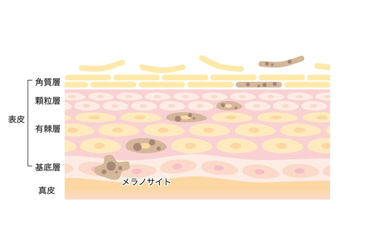 ターンオーバー流れ