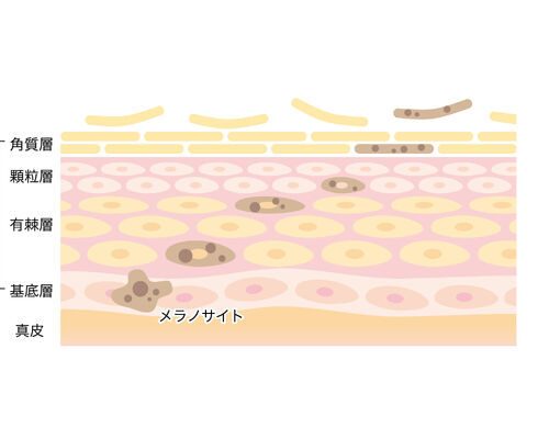 ターンオーバー流れ