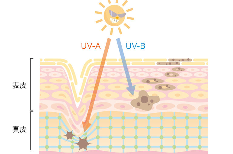 UV種類