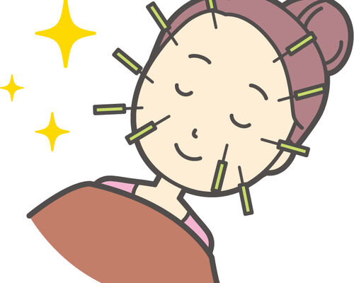 美容鍼イラスト