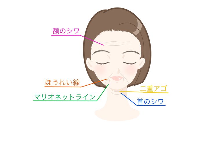 マリオ二重顎
