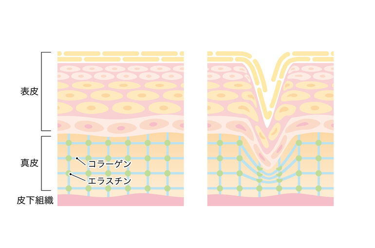 しわメカニズム肌内部