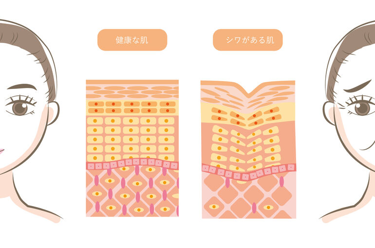 シワ肌