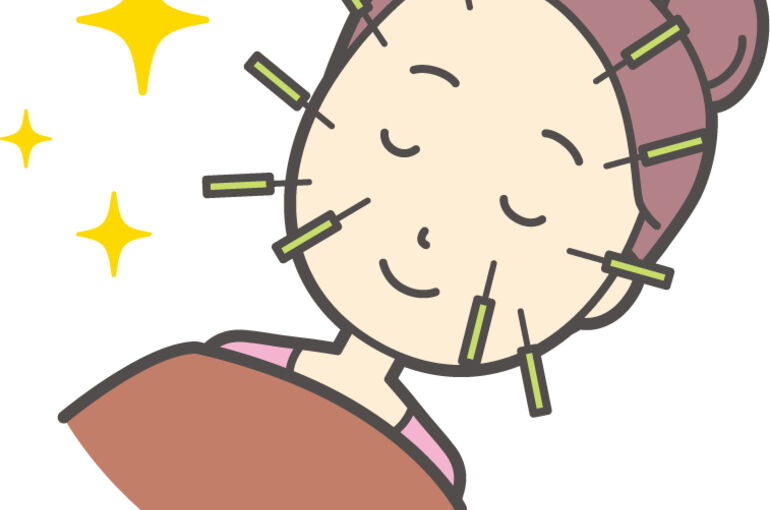 美容鍼イラスト